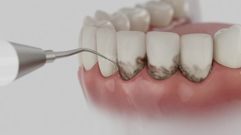 Reliable Tooth Extraction contractor in Grosse Pointe Woods, MI by Smile Center Dentistry